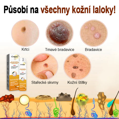 💗Sprej na odstranění bradavic a pásového oparu ze včelího jedu (👨⚕AAD Doporučujeme) 🐝🐝(🔥Nabídka na poslední den se slevou 80 %)