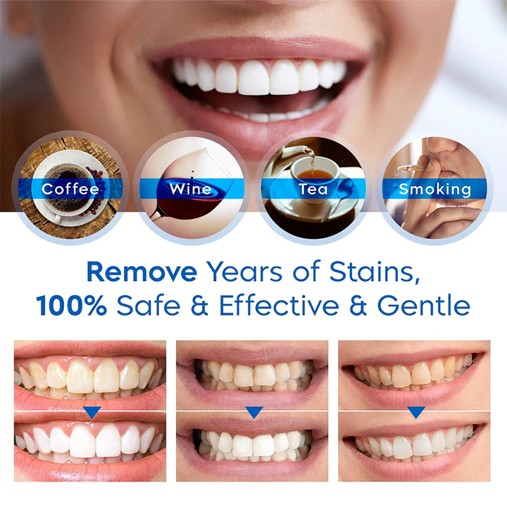 ⏳Časově omezená nabídka⏳LIMETOW™ Teeth Whitening Essence