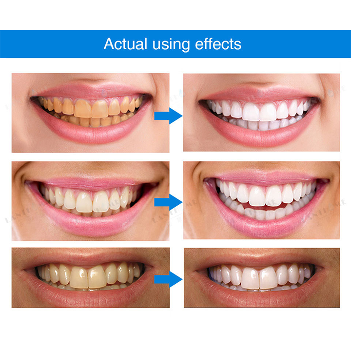 ⏳Časově omezená nabídka⏳LIMETOW™ Teeth Whitening Essence
