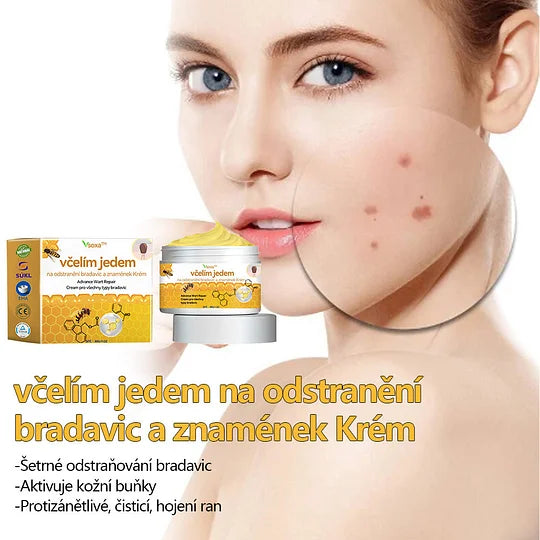💥🔥𝐕o𝐬𝐨𝐱𝐚™ 𝐕č𝐞𝐥í𝐦 𝐉𝐞𝐝𝐞𝐦 𝐍𝐚 𝐎𝐝𝐬𝐭𝐫𝐚𝐧ě𝐧í 𝐁𝐫𝐚𝐝𝐚𝐯𝐢𝐜 𝐀 𝐙𝐧𝐚𝐦é𝐧𝐞𝐤 𝐊𝐫é𝐦🐝🐝(🔥𝐏𝐫𝐨𝐩𝐚𝐠𝐚č𝐧í 𝐚𝐤𝐜𝐞 𝐧𝐚 𝐩𝐨𝐬𝐥𝐞𝐝𝐧í 𝐝𝐞𝐧 𝟖𝟎% 𝐬𝐥𝐞𝐯𝐚)🔥💥✨