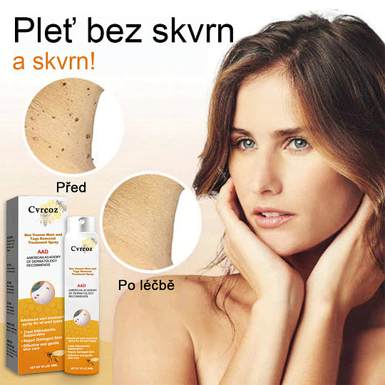 💗Sprej na odstranění bradavic a pásového oparu ze včelího jedu (👨⚕AAD Doporučujeme) 🐝🐝(🔥Nabídka na poslední den se slevou 80 %)