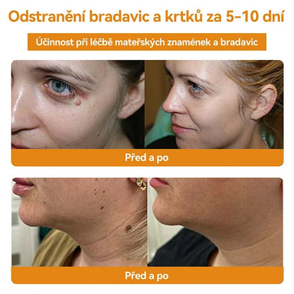 💥🔥𝐕o𝐬𝐨𝐱𝐚™ 𝐕č𝐞𝐥í𝐦 𝐉𝐞𝐝𝐞𝐦 𝐍𝐚 𝐎𝐝𝐬𝐭𝐫𝐚𝐧ě𝐧í 𝐁𝐫𝐚𝐝𝐚𝐯𝐢𝐜 𝐀 𝐙𝐧𝐚𝐦é𝐧𝐞𝐤 𝐊𝐫é𝐦🐝🐝(🔥𝐏𝐫𝐨𝐩𝐚𝐠𝐚č𝐧í 𝐚𝐤𝐜𝐞 𝐧𝐚 𝐩𝐨𝐬𝐥𝐞𝐝𝐧í 𝐝𝐞𝐧 𝟖𝟎% 𝐬𝐥𝐞𝐯𝐚)🔥💥✨