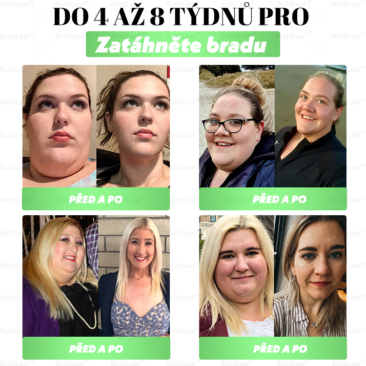 Oficiální obchod | BuildLeaf® GLP-1 20-v-1 Slim & Zdraví orální roztok 💧 (1× denně, výsledky za 7 dní). Obsahuje 100 mld. CFU probiotik ✅ Podporuje hubnutí, zdraví srdce ❤️, trávení i energii.