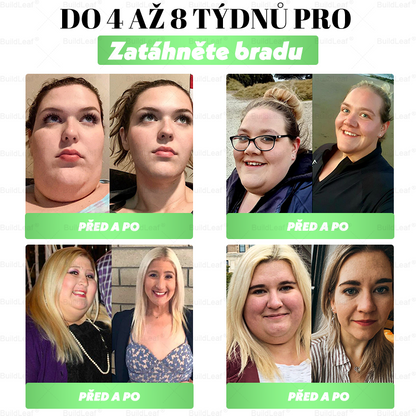 Oficiální obchod | BuildLeaf® GLP-1 20-v-1 Slim & Zdraví orální roztok 💧 (1× denně, výsledky za 7 dní). Obsahuje 100 mld. CFU probiotik ✅ Podporuje hubnutí, zdraví srdce ❤️, trávení i energii.