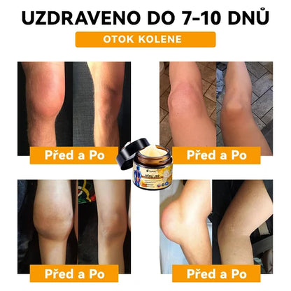 【✨𝗗𝗼𝗯𝗶́𝗿𝗸𝗮✨】𝗔𝗲𝘁𝗵𝗲𝗿𝗶𝘀™ 𝗞𝗿𝗲́𝗺 𝗽𝗿𝗼𝘁𝗶 𝗮𝗿𝘁𝗿𝗶𝘁𝗶𝗱ě 𝘀𝗲 𝘃č𝗲𝗹𝗶́𝗺 𝗷𝗲𝗱𝗲𝗺