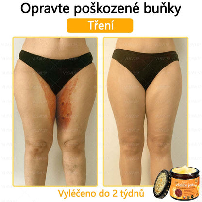 Foulme® Profesionální krém na odstranění včelího jedu🐝