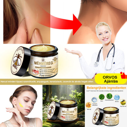 🐝BSWELL® Krém na ošetření včelím jedem👨‍⚕️（MDT ajánlott） 🔥poslední den propagace 80% vypnuto