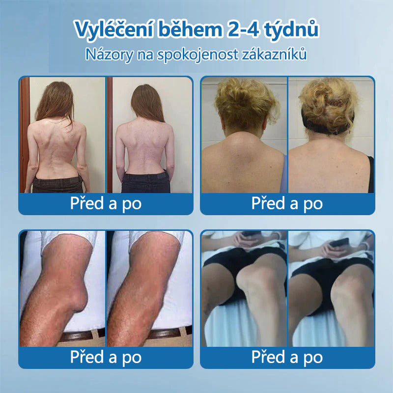 Lékárna Na Poště | Foulme® BPC-157 Regenerační krém na klouby 🦴 Léčí artritidu, neuropatii, revmatismus, sportovní zranění a další potíže 👍