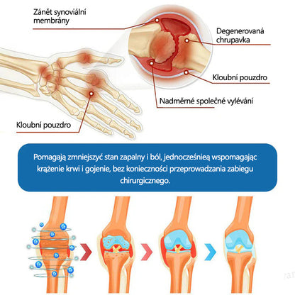 Lékárna Na Poště | Foulme® BPC-157 Regenerační krém na klouby 🦴 Léčí artritidu, neuropatii, revmatismus, sportovní zranění a další potíže 👍
