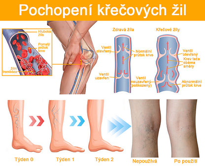 【✨Dobírka✨】Sprej na křečové žíly Furzero™ Bee Venom🐝🐝🐝