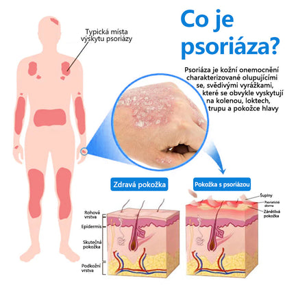 ✅Zvoevo® Magnesium bylinný sprej ⚕️ Certifikace MHRA – úleva při psoriáze, ekzému, intimních bakteriálních infekcích, akné a tmavých skvrnách