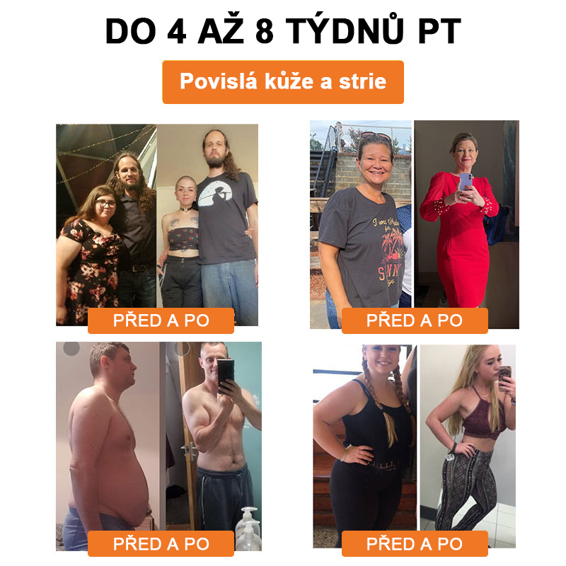 🐝Lymfodrenážní zeštíhlující náplast Swan Bella™ se včelím jedem 🔥 70% sleva po omezenou dobu 🔥 (Vhodné pro všechny věkové kategorie).