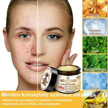 🐝BSWELL® Krém na ošetření včelím jedem👨‍⚕️（MDT ajánlott） 🔥poslední den propagace 80% vypnuto