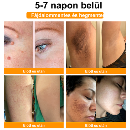 🐝BSWELL® Krém na ošetření včelím jedem👨‍⚕️（MDT ajánlott） 🔥poslední den propagace 80% vypnuto