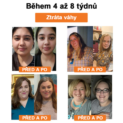 🐝Lymfodrenážní zeštíhlující náplast Swan Bella™ se včelím jedem 🔥 70% sleva po omezenou dobu 🔥 (Vhodné pro všechny věkové kategorie).