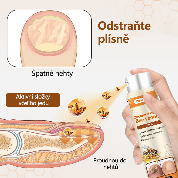 ✅【Oficiální vlajkový obchod】Ceoerty® Záchrana nehtů Včelí jed ve spreji 💥💥💥