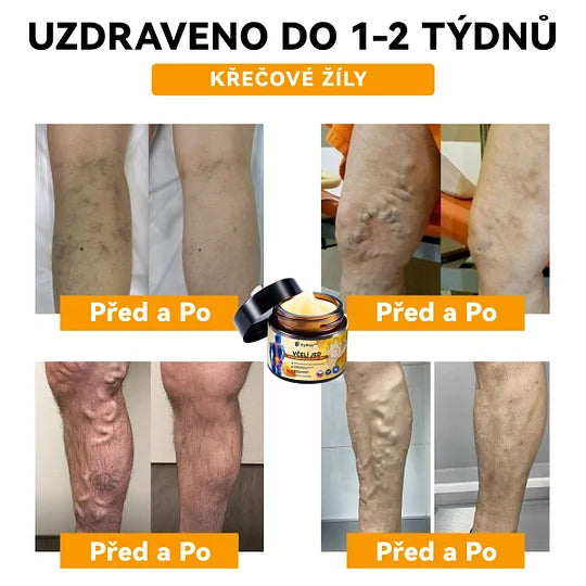 【✨𝗗𝗼𝗯𝗶́𝗿𝗸𝗮✨】𝗔𝗲𝘁𝗵𝗲𝗿𝗶𝘀™ 𝗞𝗿𝗲́𝗺 𝗽𝗿𝗼𝘁𝗶 𝗮𝗿𝘁𝗿𝗶𝘁𝗶𝗱ě 𝘀𝗲 𝘃č𝗲𝗹𝗶́𝗺 𝗷𝗲𝗱𝗲𝗺