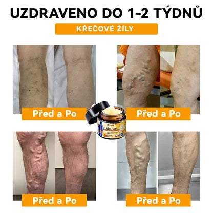 【✨𝗗𝗼𝗯𝗶́𝗿𝗸𝗮✨】𝗔𝗲𝘁𝗵𝗲𝗿𝗶𝘀™ 𝗞𝗿𝗲́𝗺 𝗽𝗿𝗼𝘁𝗶 𝗮𝗿𝘁𝗿𝗶𝘁𝗶𝗱ě 𝘀𝗲 𝘃č𝗲𝗹𝗶́𝗺 𝗷𝗲𝗱𝗲𝗺