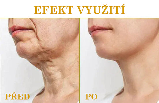 【✨Dobírka✨】Sleva na poslední den: 𝟕𝟎% 𝐎𝐅𝐅 LEFUN® Zpevňující regenerační olej na pleť🔥