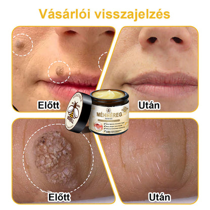 🐝BSWELL® Krém na ošetření včelím jedem👨‍⚕️（MDT ajánlott） 🔥poslední den propagace 80% vypnuto