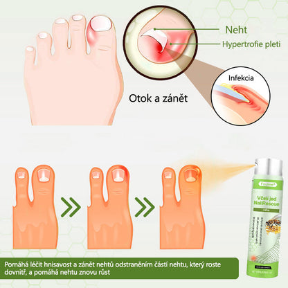 Lékárna Na Poště Oficiální obchod | Foulme® NailRescue Včelí jed ve spreji