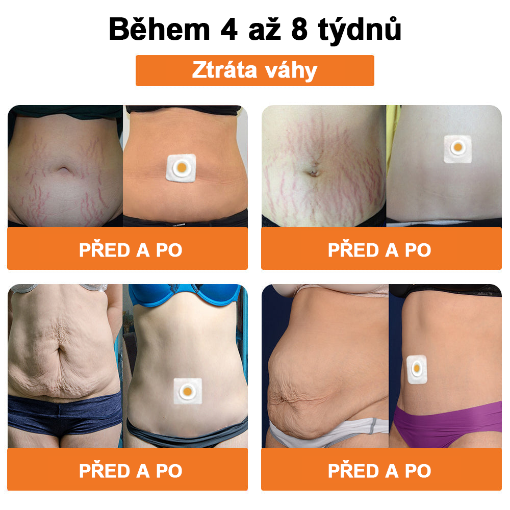 🐝Lymfodrenážní zeštíhlující náplast Swan Bella™ se včelím jedem 🔥 70% sleva po omezenou dobu 🔥 (Vhodné pro všechny věkové kategorie).