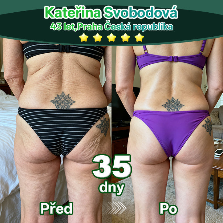 Lotmay® Kapky s kmenovými buňkami a kolagenovými peptidy pro vnitřní použití👩‍⚕️ (Zpevnění a lifting povolené pokožky & redukce tvorby vrásek) 🍀💥