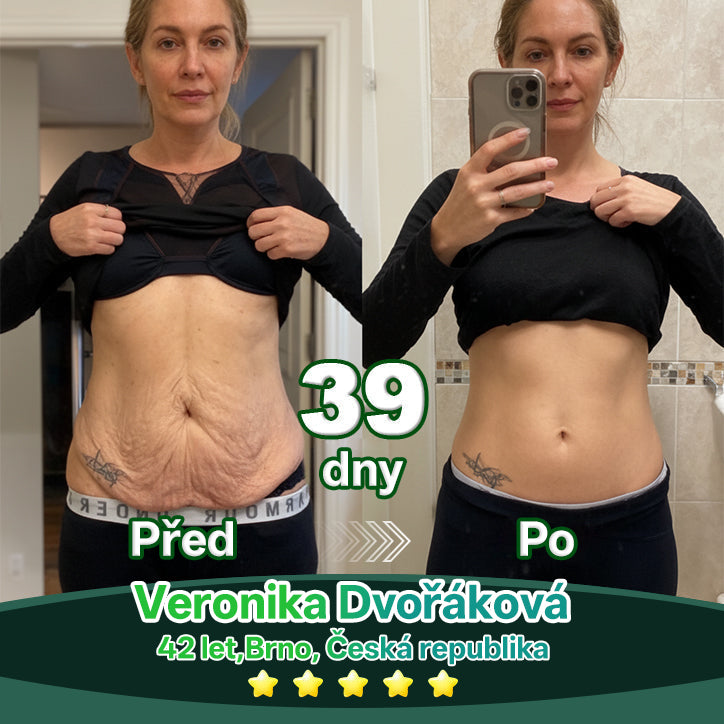 Lotmay® Kapky s kmenovými buňkami a kolagenovými peptidy pro vnitřní použití👩‍⚕️ (Zpevnění a lifting povolené pokožky & redukce tvorby vrásek) 🍀💥