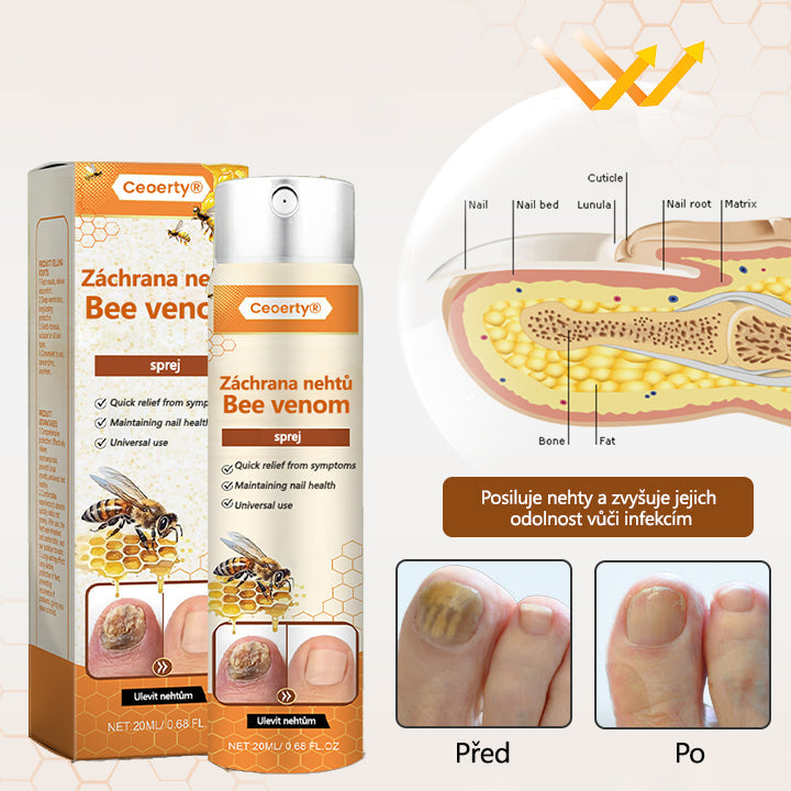 ✅【Oficiální vlajkový obchod】Ceoerty® Záchrana nehtů Včelí jed ve spreji 💥💥💥