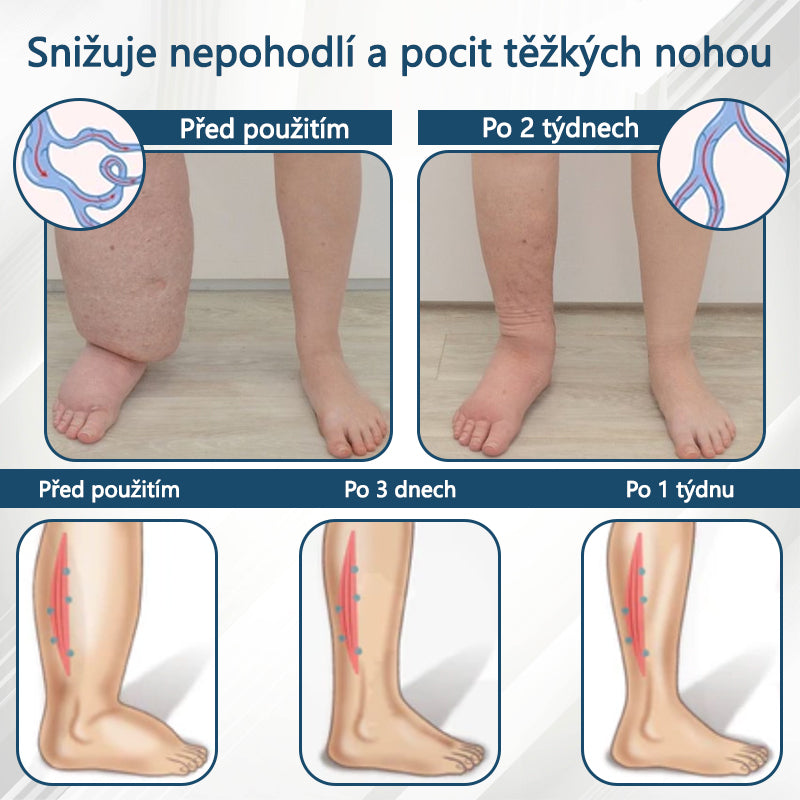 Cvreoz® Černý kmín Edema Detoxikační bylinný krém