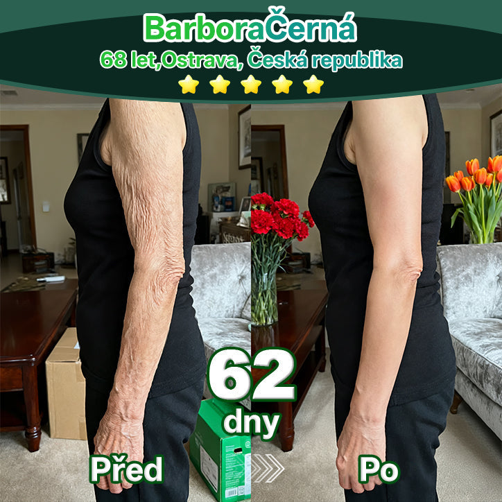 Lotmay® Kapky s kmenovými buňkami a kolagenovými peptidy pro vnitřní použití👩‍⚕️ (Zpevnění a lifting povolené pokožky & redukce tvorby vrásek) 🍀💥