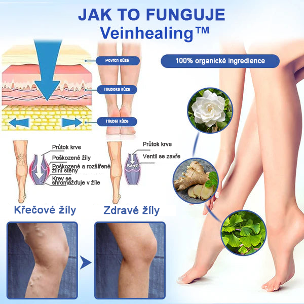 🌱🌠✨Sprej na léčbu křečových žil Veinhealing™🌿