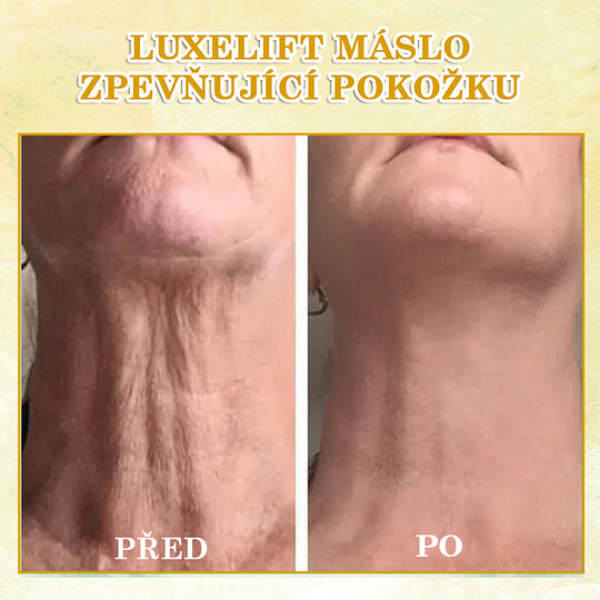 【✨Dobírka✨】Sleva na poslední den: 𝟕𝟎% 𝐎𝐅𝐅 LEFUN® Zpevňující regenerační olej na pleť🔥