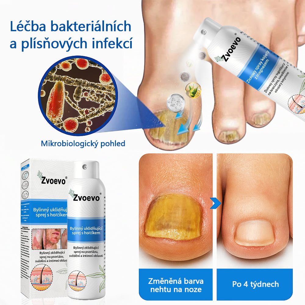 ✅Zvoevo® Magnesium bylinný sprej ⚕️ Certifikace MHRA – úleva při psoriáze, ekzému, intimních bakteriálních infekcích, akné a tmavých skvrnách