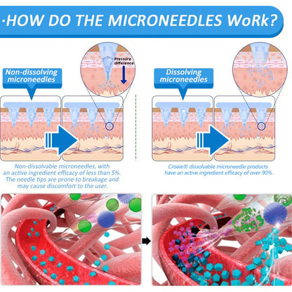 Croaie® Nano Microneedle Patch with SMGT-GLP-1 & Matrixyl 3000 – Slimming,👨‍⚕️👨‍⚕️ Skin Tightening, Blood Sugar Support, No Injection, 7-Day Result