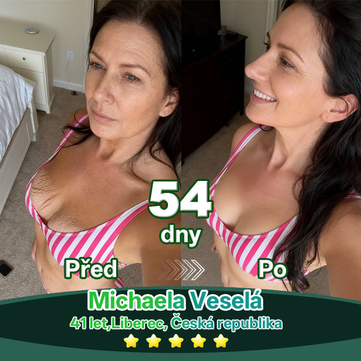 Lotmay® Kapky s kmenovými buňkami a kolagenovými peptidy pro vnitřní použití👩‍⚕️ (Zpevnění a lifting povolené pokožky & redukce tvorby vrásek) 🍀💥