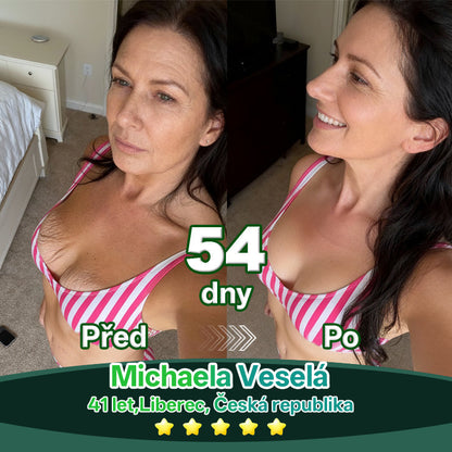 Lotmay® Kapky s kmenovými buňkami a kolagenovými peptidy pro vnitřní použití👩‍⚕️ (Zpevnění a lifting povolené pokožky & redukce tvorby vrásek) 🍀💥