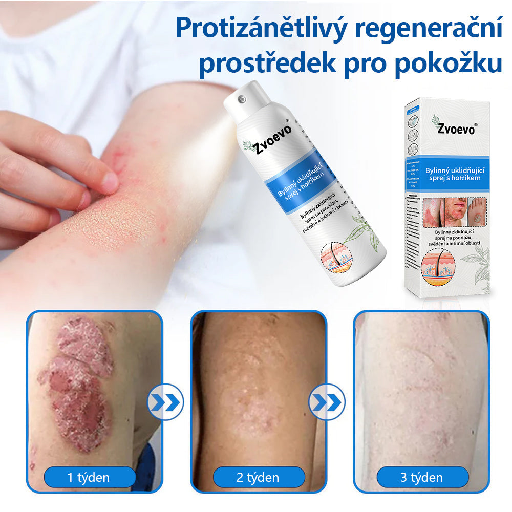 ✅Zvoevo® Magnesium bylinný sprej ⚕️ Certifikace MHRA – úleva při psoriáze, ekzému, intimních bakteriálních infekcích, akné a tmavých skvrnách