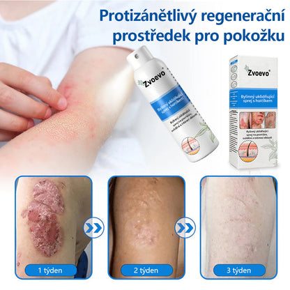 ✅Zvoevo® Magnesium bylinný sprej ⚕️ Certifikace MHRA – úleva při psoriáze, ekzému, intimních bakteriálních infekcích, akné a tmavých skvrnách