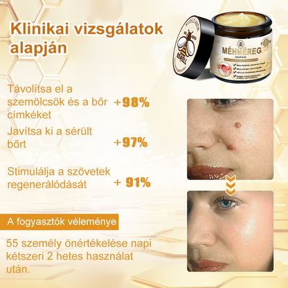🐝BSWELL® Krém na ošetření včelím jedem👨‍⚕️（MDT ajánlott） 🔥poslední den propagace 80% vypnuto