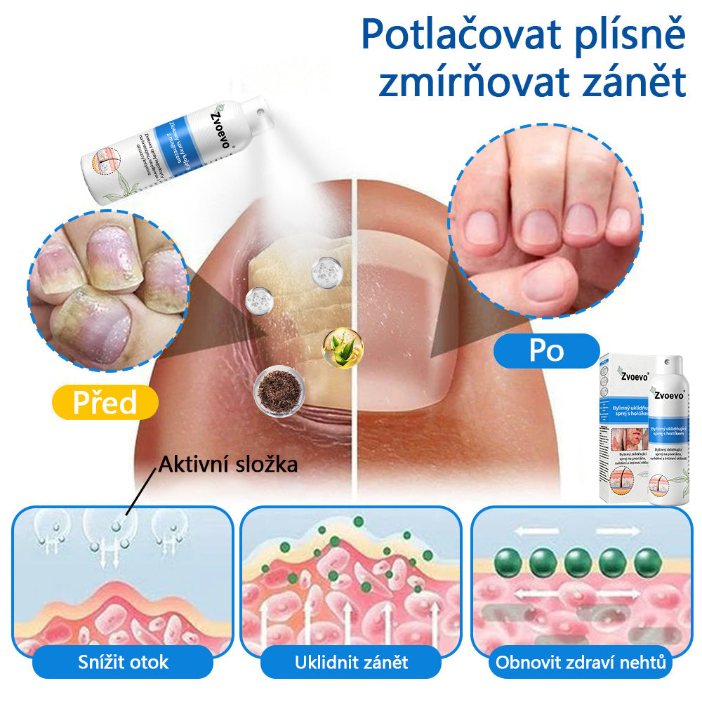 ✅Zvoevo® Magnesium bylinný sprej ⚕️ Certifikace MHRA – úleva při psoriáze, ekzému, intimních bakteriálních infekcích, akné a tmavých skvrnách