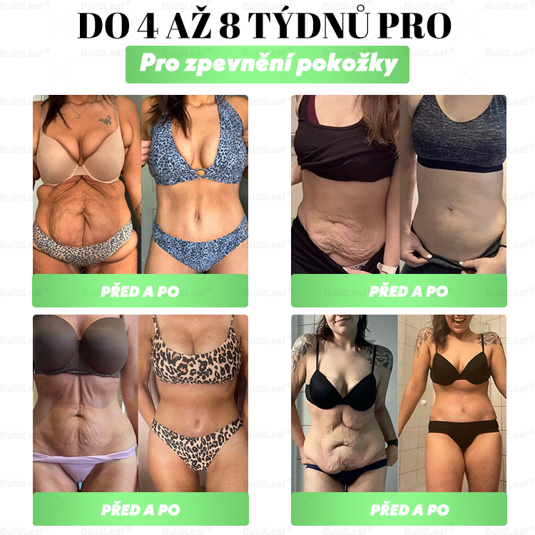 Oficiální obchod | BuildLeaf® GLP-1 20-v-1 Slim & Zdraví orální roztok 💧 (1× denně, výsledky za 7 dní). Obsahuje 100 mld. CFU probiotik ✅ Podporuje hubnutí, zdraví srdce ❤️, trávení i energii.
