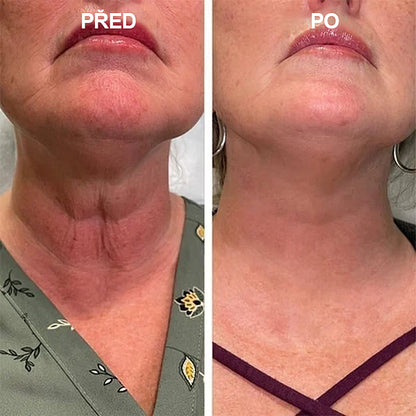 【✨Dobírka✨】Sleva na poslední den: 𝟕𝟎% 𝐎𝐅𝐅 LEFUN® Zpevňující regenerační olej na pleť🔥