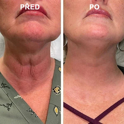 【✨Dobírka✨】Poslední den akce 80% sleva - Fubsta™ Skin Firming Rejuvenation Serum🔥