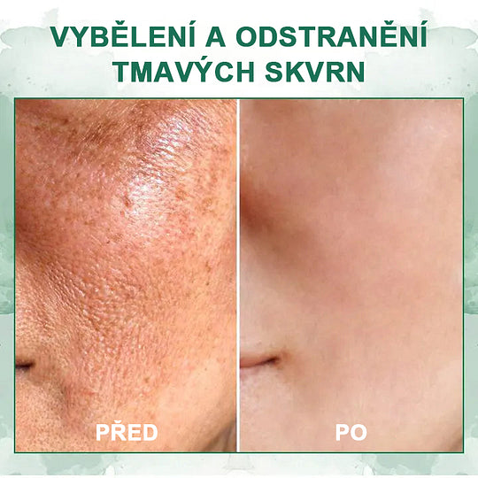【✨Dobírka✨】Poslední den akce 80% sleva - Fubsta™ Skin Firming Rejuvenation Serum🔥