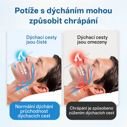Fivfivgo® SnoreLess nosní dechový přístroj💥💥